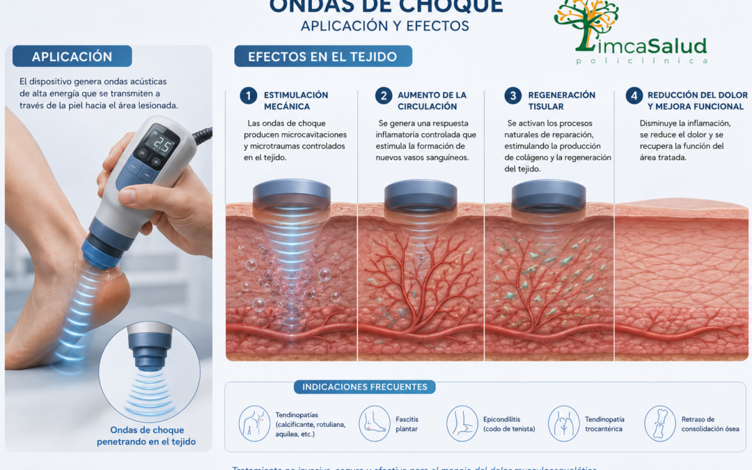 ONDAS DE CHOQUE, ahora incluidas en tu sesión de Fisioterapia